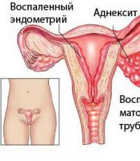 Stomaku ndihet i shtrënguar, si para menstruacioneve