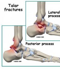Struktura e kyçit të kyçit të këmbës
